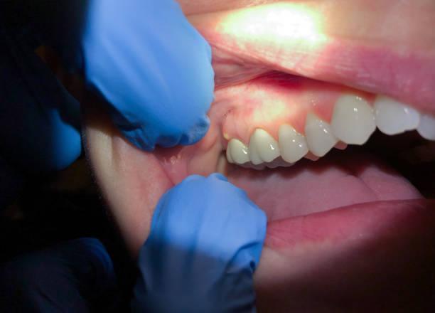 Best Emergency Cosmetic Dentistry (e.g., broken veneers) in Angleton, TX